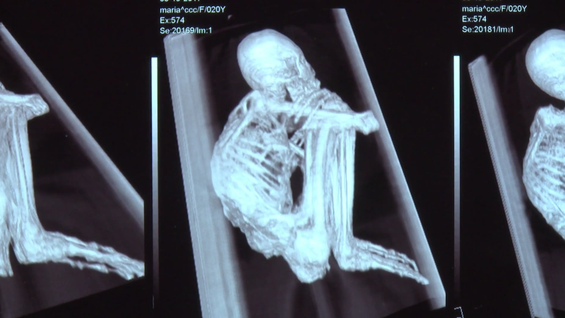 6 X Ray Of Mummy