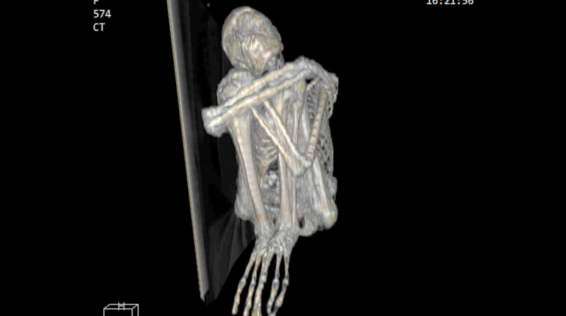 7 X Ray 2